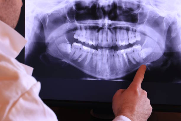 Best Emergency Tooth Extraction in Macon, MO